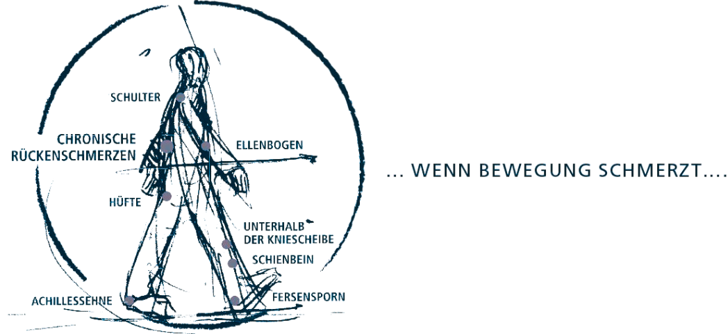 Illustration einer gehenden Person mit Markierungen an Schulter, Rücken, Hüfte, Knie, Schienbein, Achillessehne und Ferse